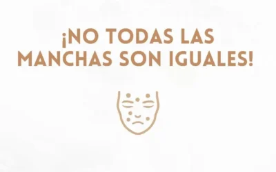 ¡No Todas las Manchas en la Piel Son Iguales! Aprende a Identificarlas y Tratarlas