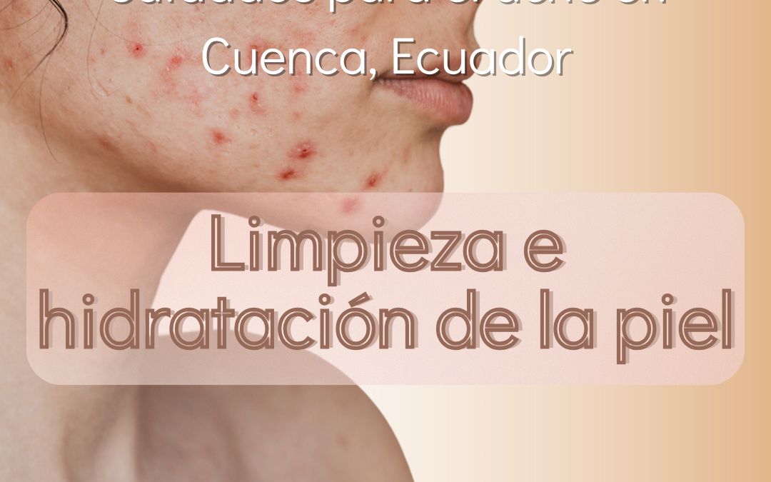 Cuidados para el acné en Cuenca, Ecuador: