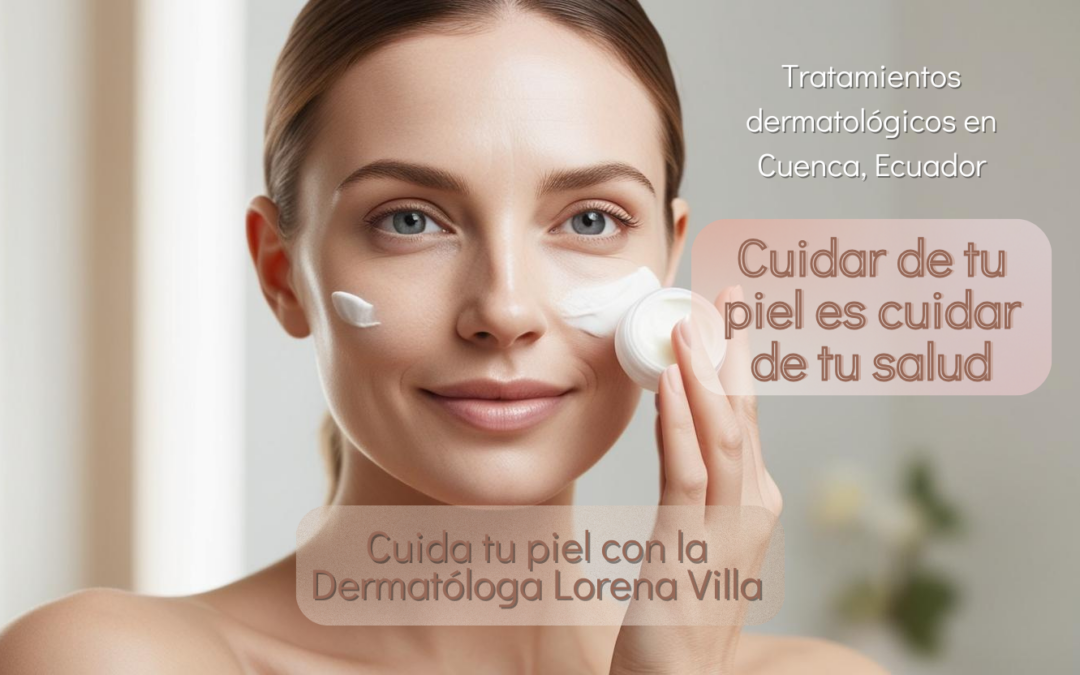 Cuidar tu piel es salud: Dermatología en Cuenca, Ecuador