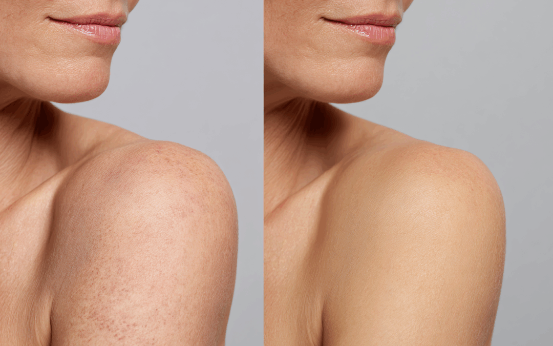 Skincare in Ecuador: A Guide to Radiant and Healthy Skin