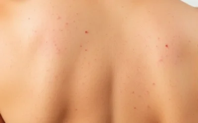 SkinCare in Ecuador: A Dermatological Guide to Healthy Skin
