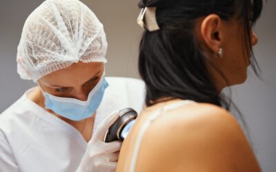 Tratamientos dermatológicos en Cuenca para una piel saludable