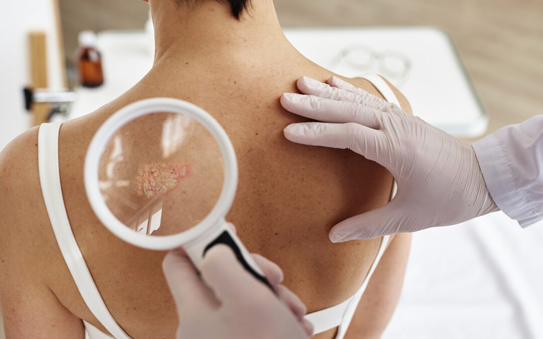 Guía de cuidado dermatológico en Ecuador: Secretos para piel sana.