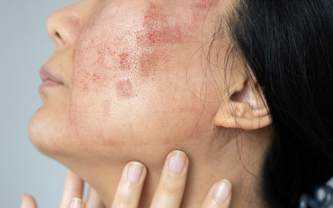 Guía Dermatológica para un Rostro en Calma