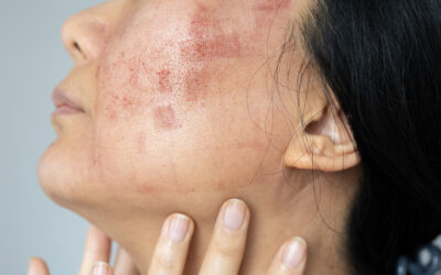 Guía Dermatológica para un Rostro en Calma