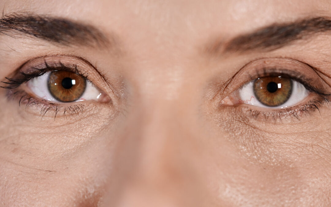 Tratamiento para Ojeras en Cuenca: FAQ Médico