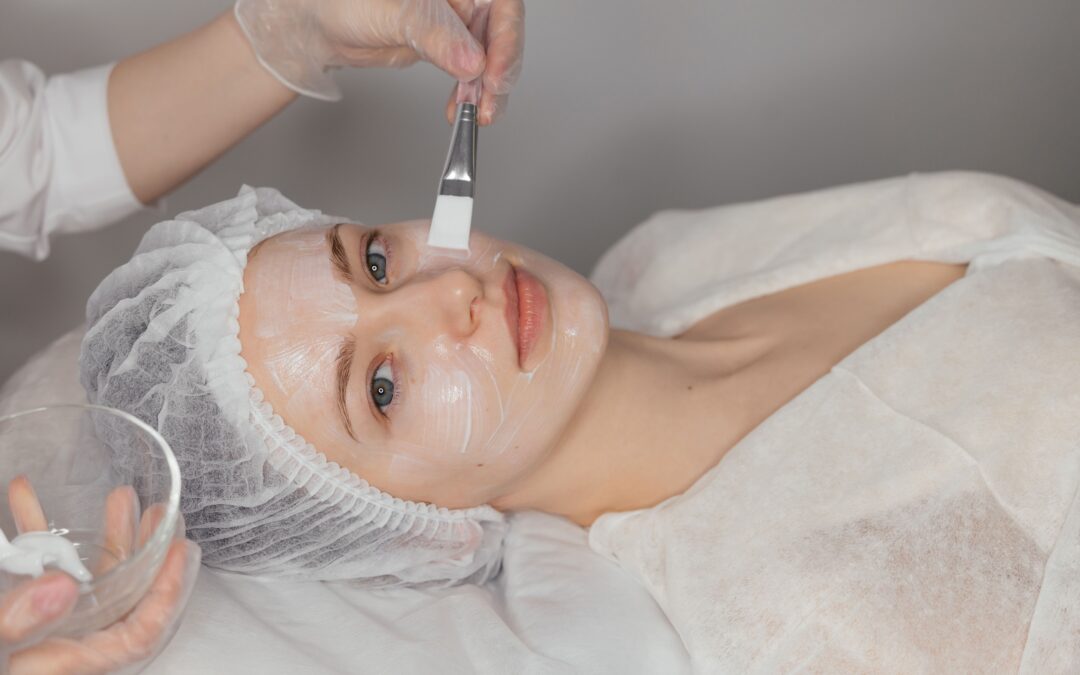 Peeling químico facial: el secreto para una piel radiante Ecuador
