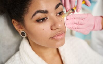 Rejuvenecimiento facial natural con ácido hialurónico en Ecuador