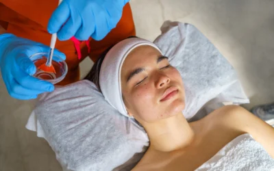Peeling químico facial en Ecuador: renueva tu piel dermatológicamente