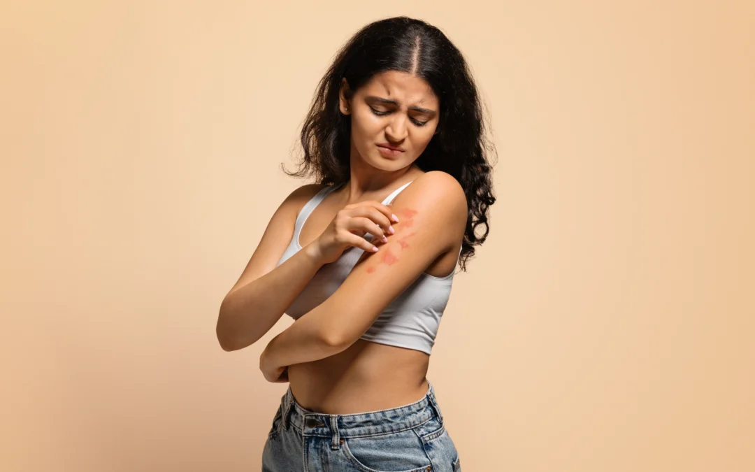 Complete guide to psoriasis: causes, symptoms, and treatments
